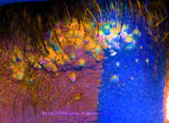 achat sildenafil mylan prezzo