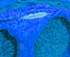 sildenafil citrate tablets