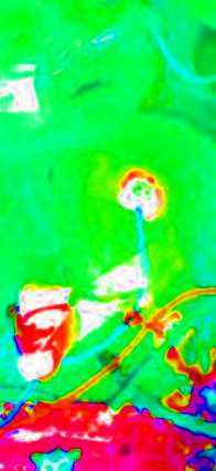 sildenafil feminin zurich